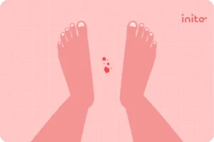 Ovulation Bleeding