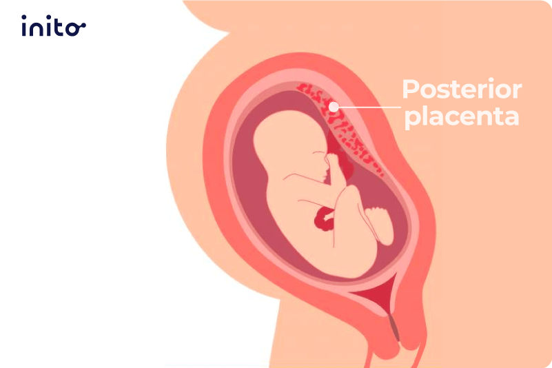 what-does-it-mean-to-have-a-posterior-placenta-inito