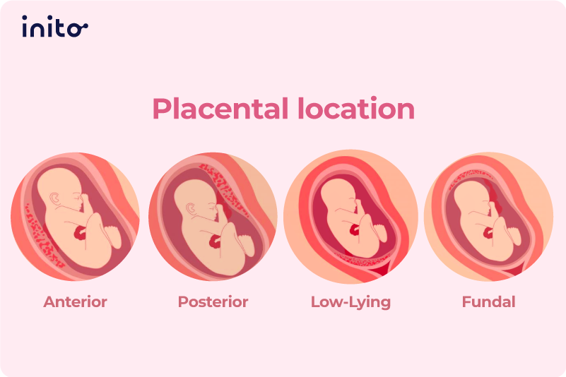 Placenta 02 R 