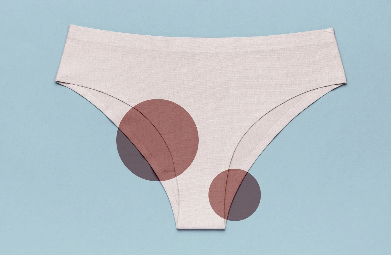 Brown discharge during pregnancy