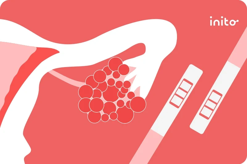 ovulation test with PCOS