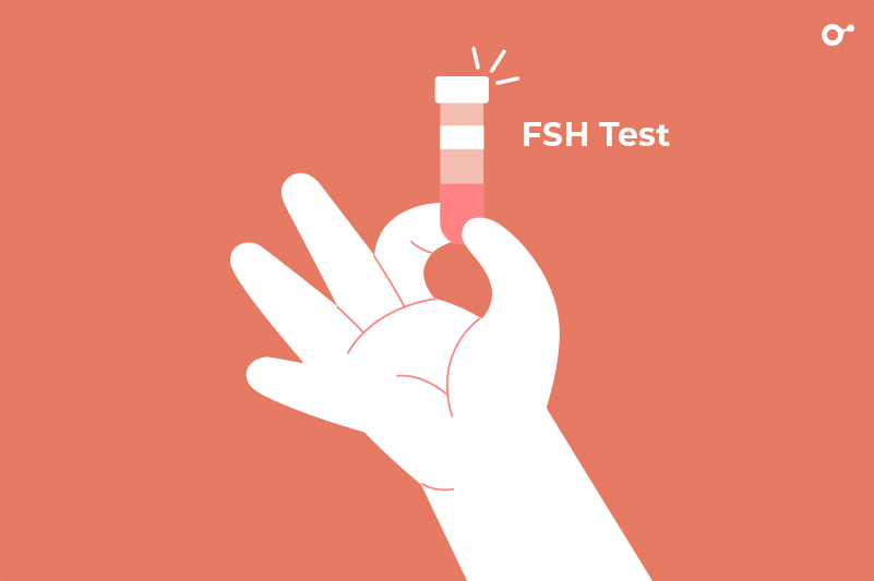 FSH TEST