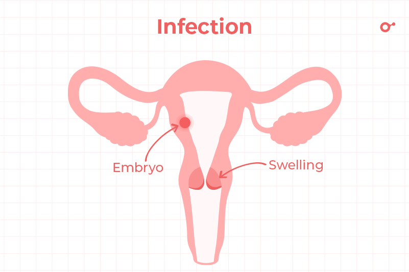 INITO 2023 Blog Can you have a period and be pregnant 6C