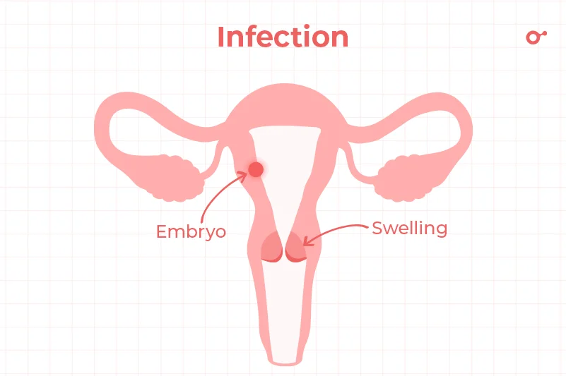 Infection