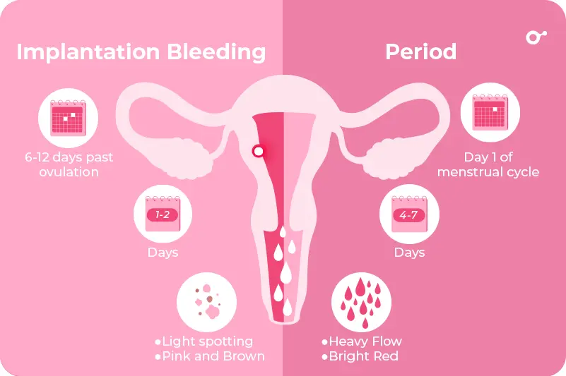 Implantation Bleeding Vs Period