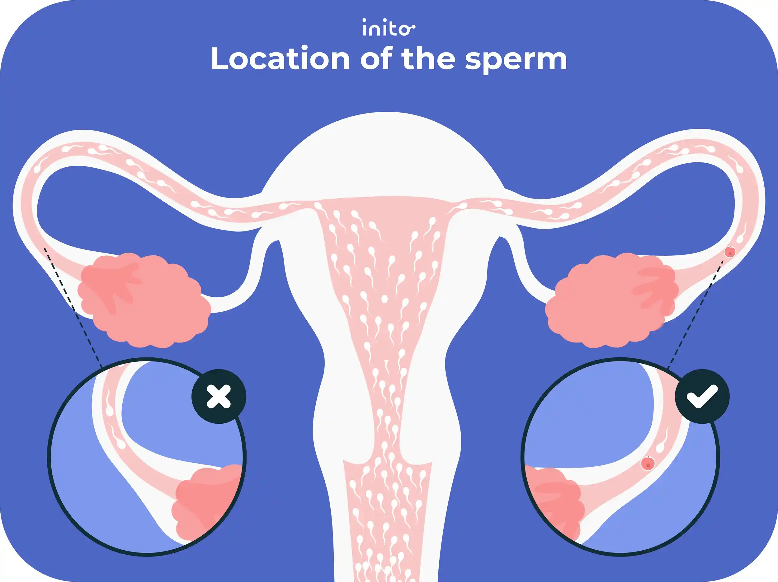 Location of the sperm