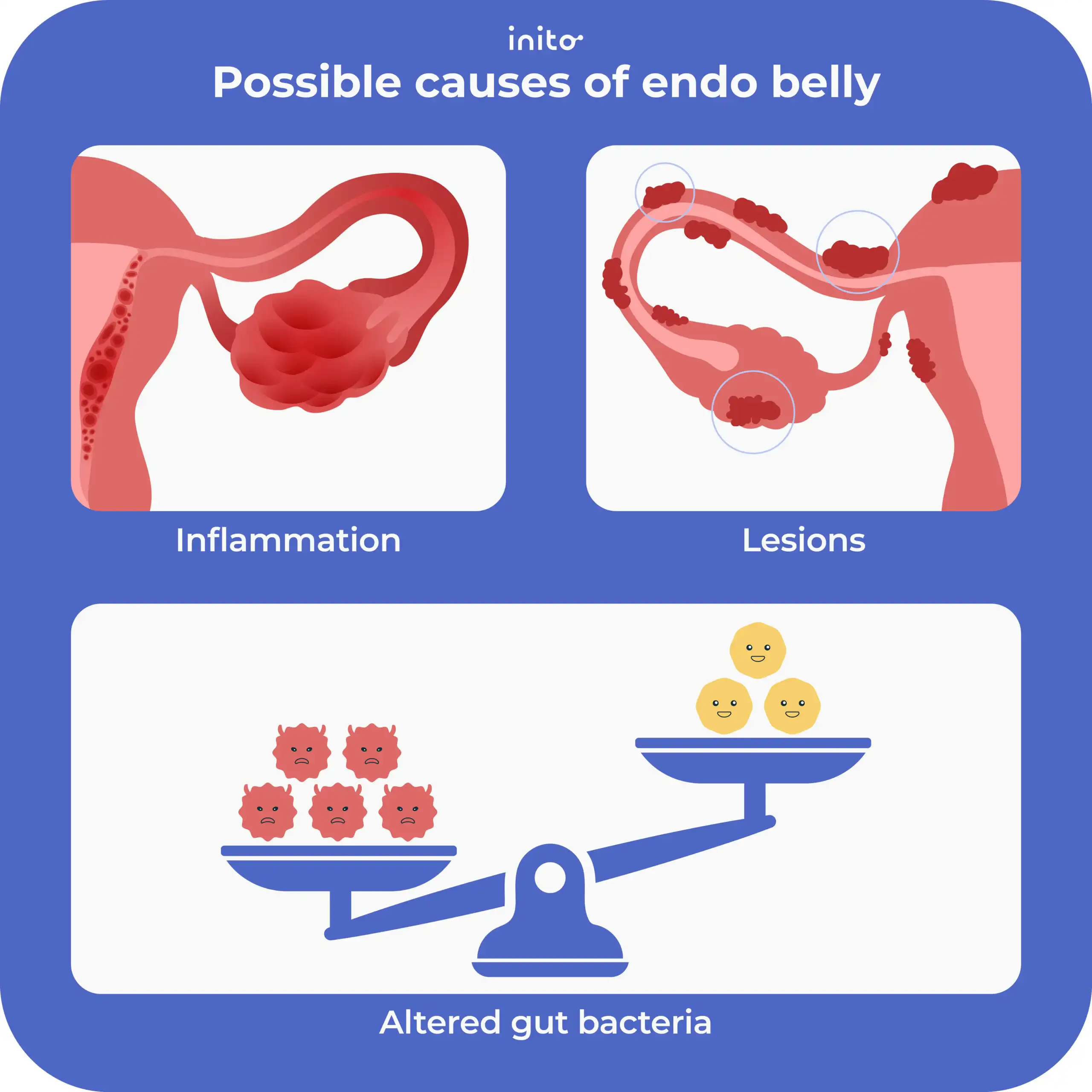 Possible causes of endometriosis belly