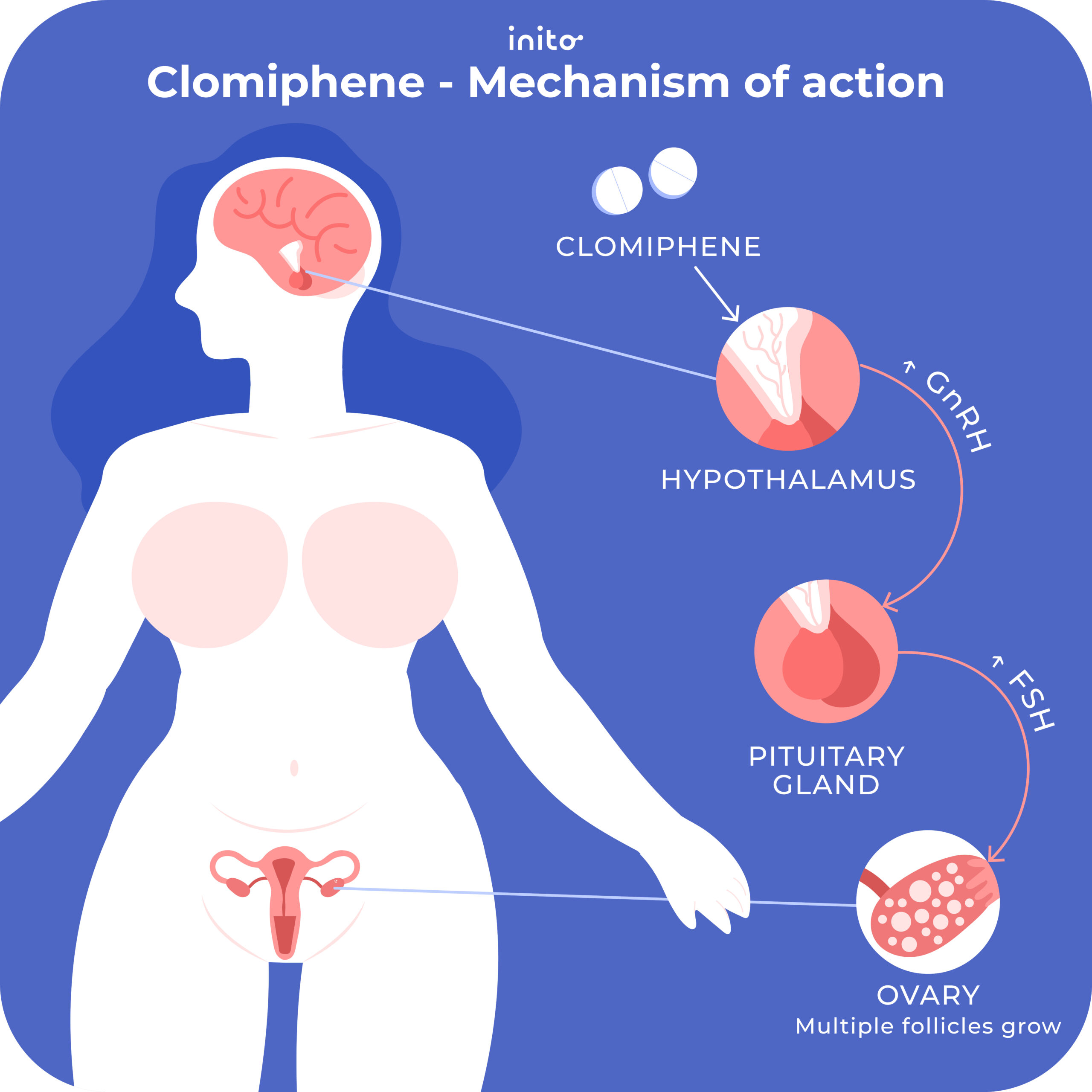 Clomid works