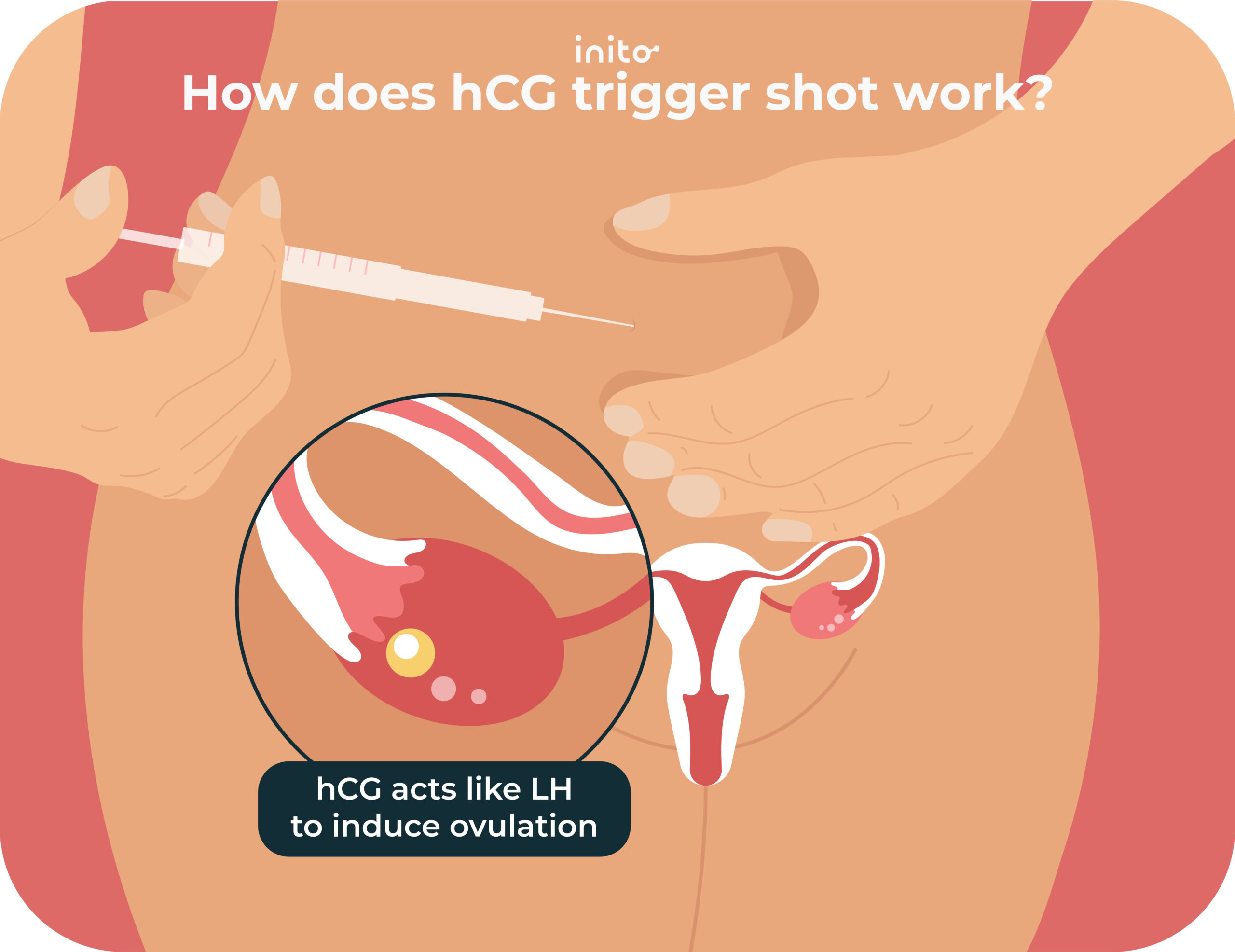  hCG trigger shot work