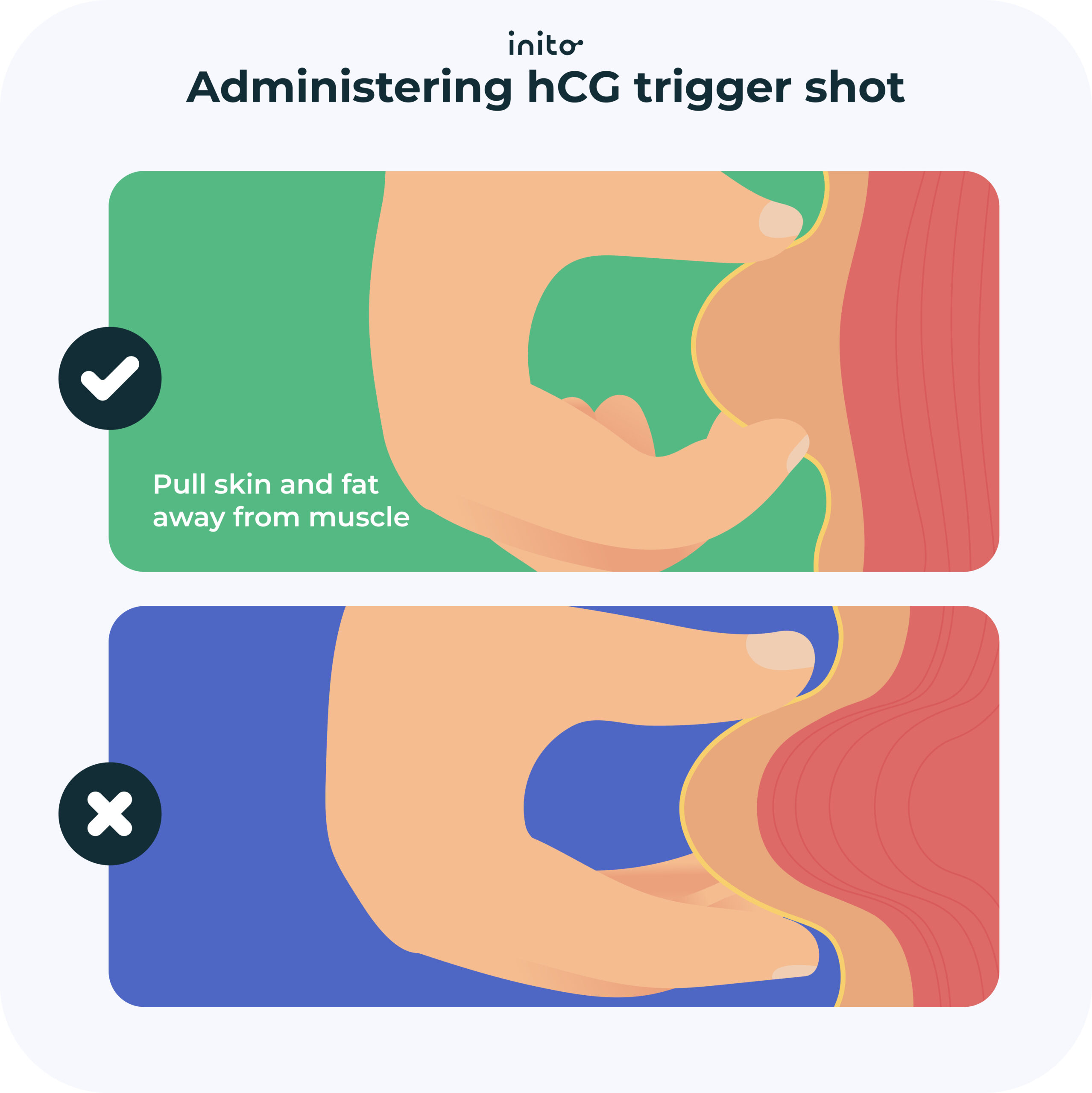 Proper administration hcg shot
