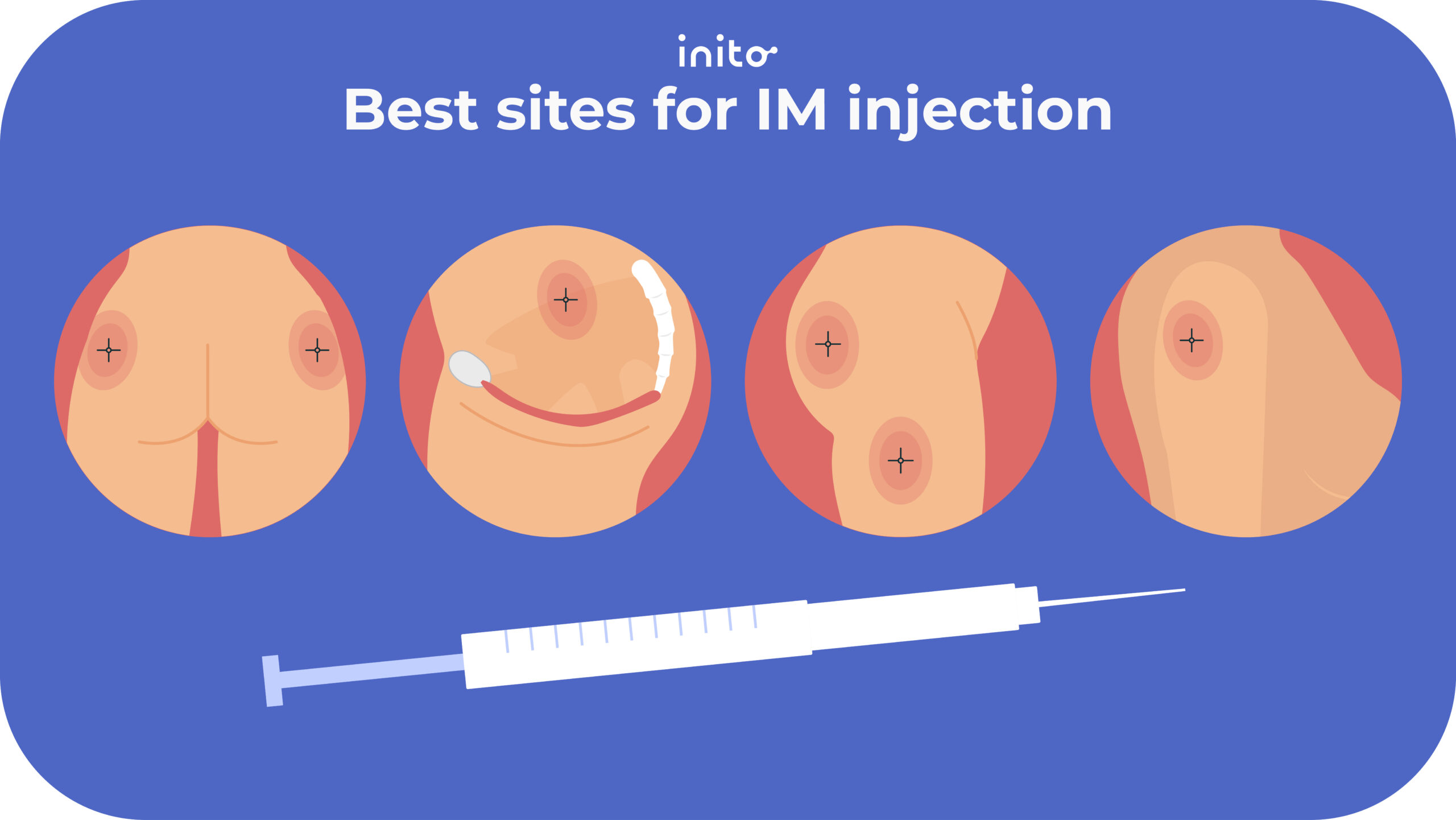 Best sites for IM injection 