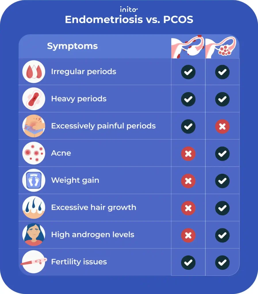 Endometriosis vs. PCOS