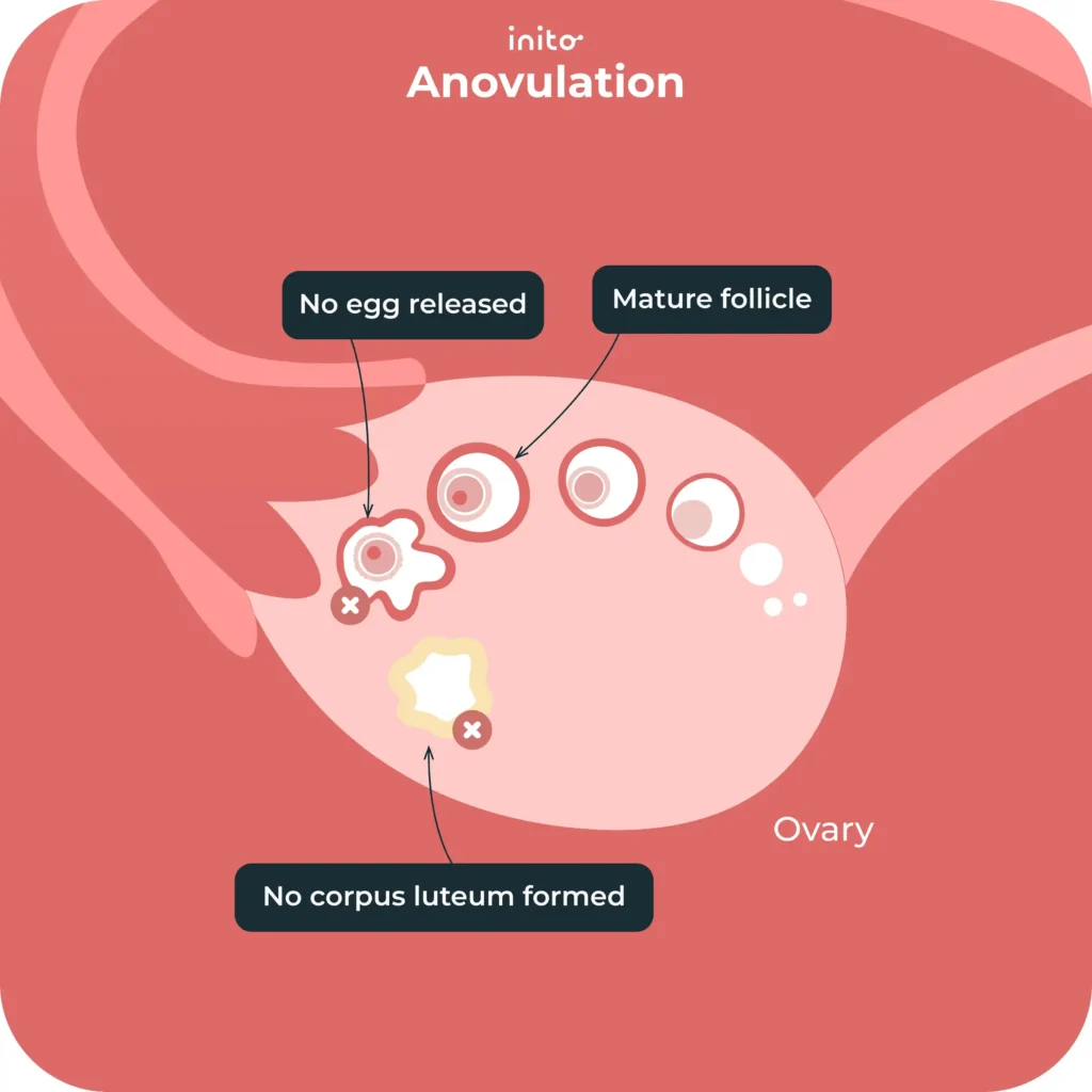 Anovulation