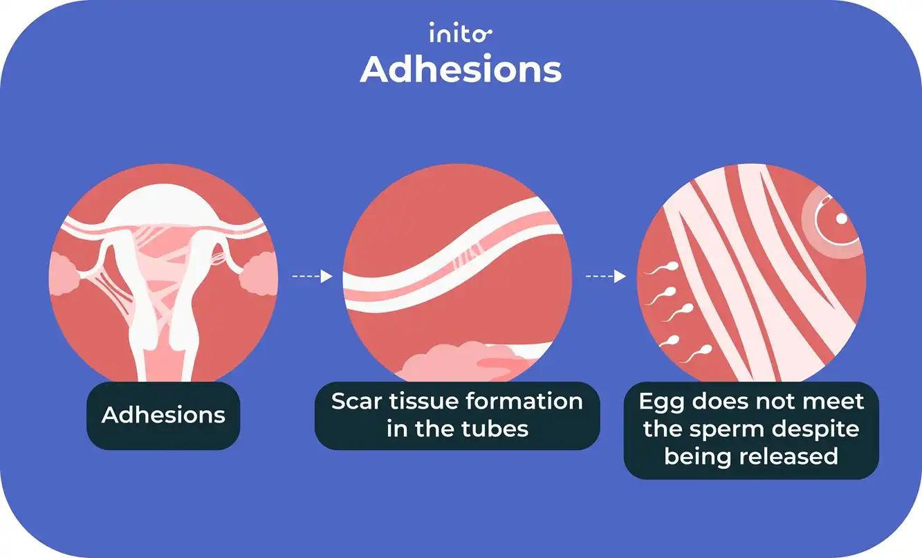 Adhesions