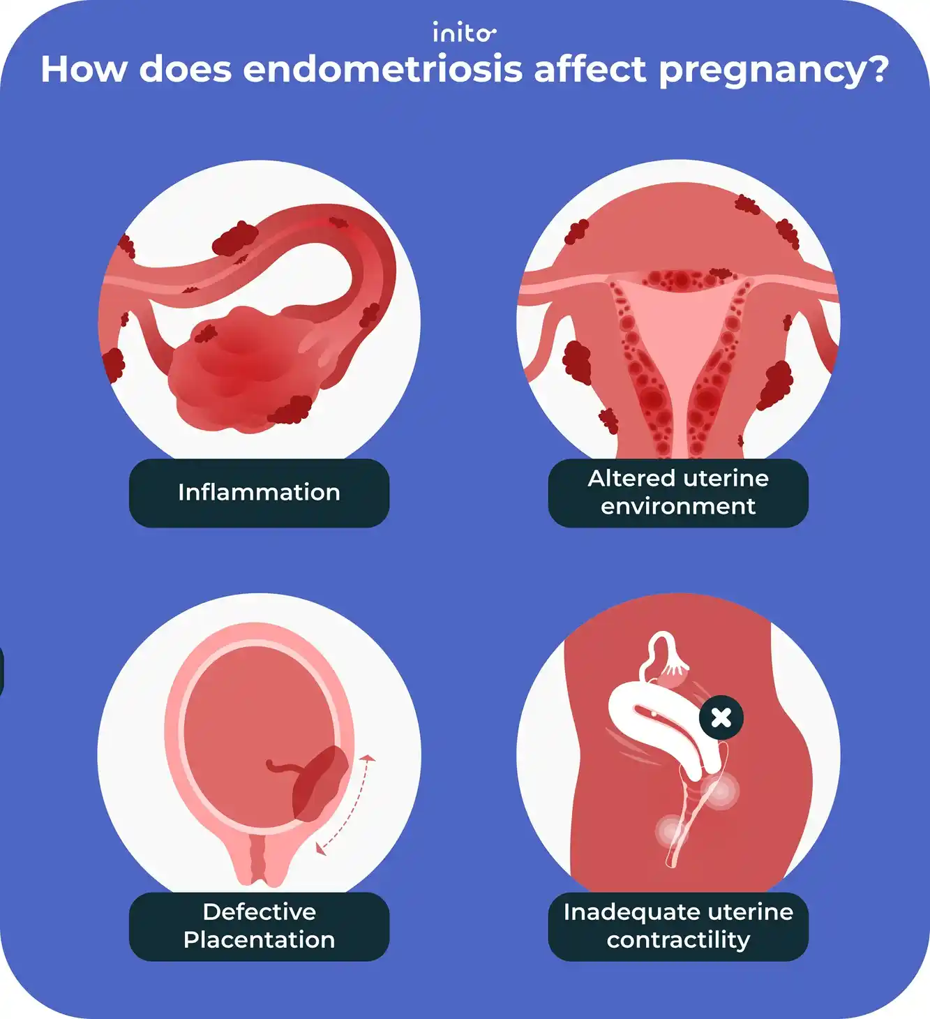 How does endometriosis affect pregnancy?