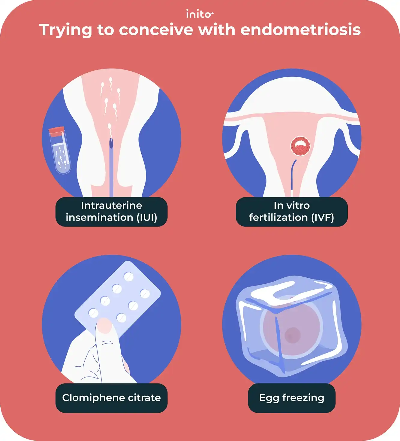 Trying to conceive with endometriosis