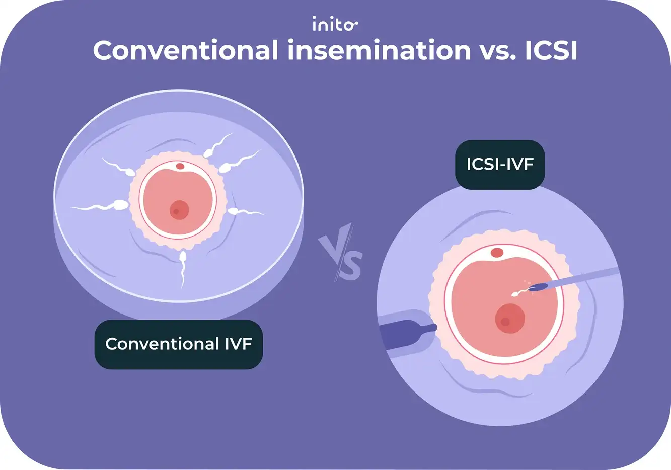 Conventional insemination vs ICSI