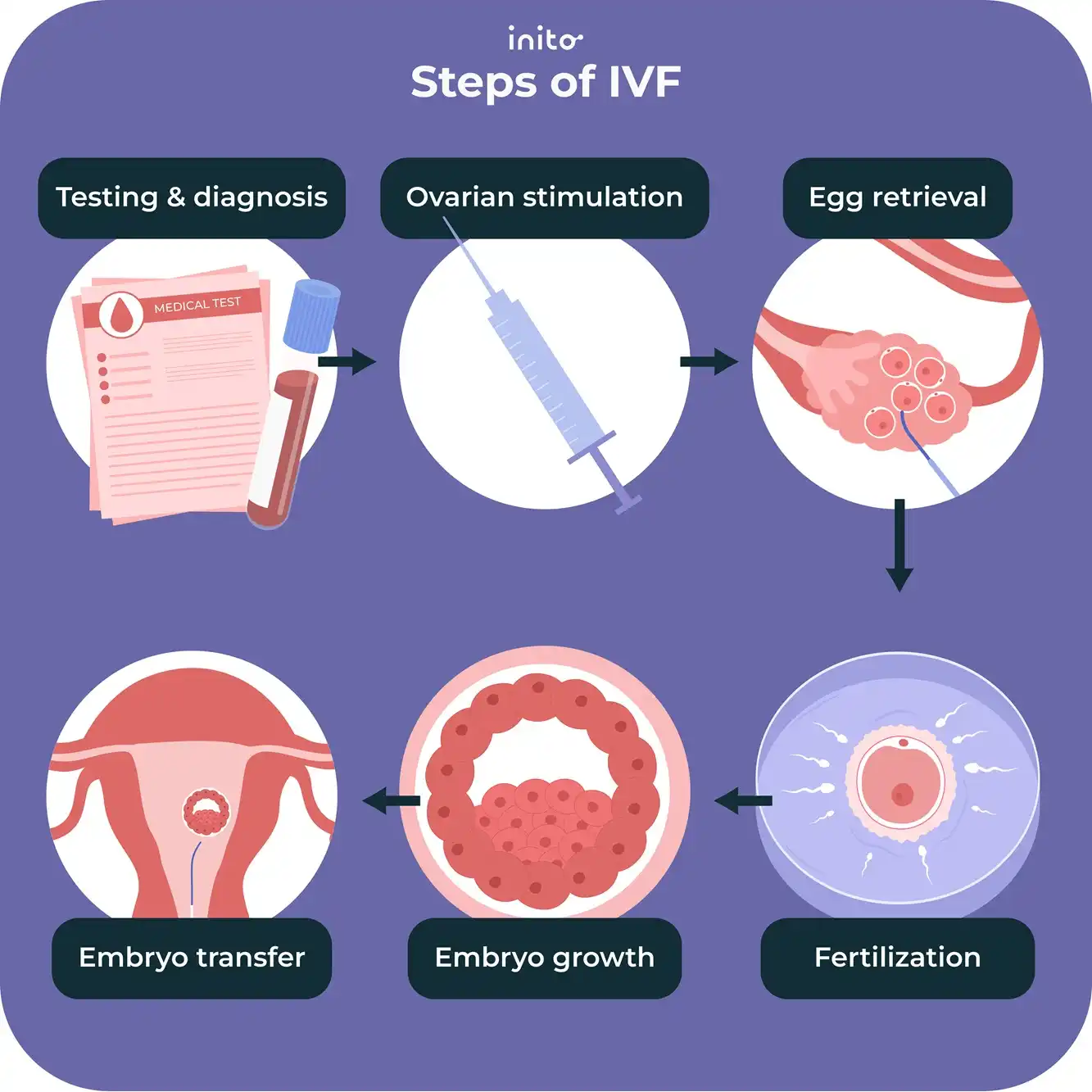 Steps of IVF