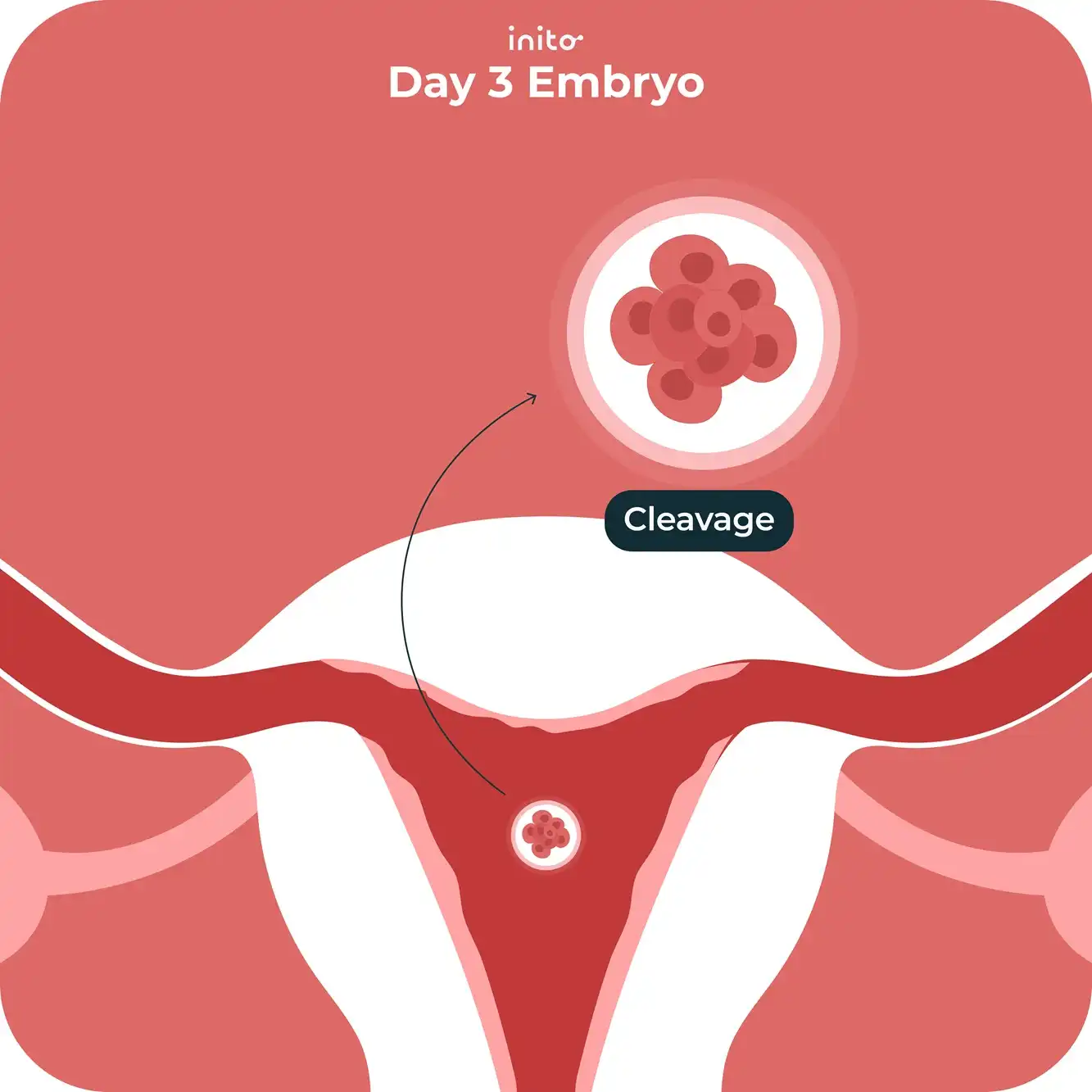 Day 3 embryo