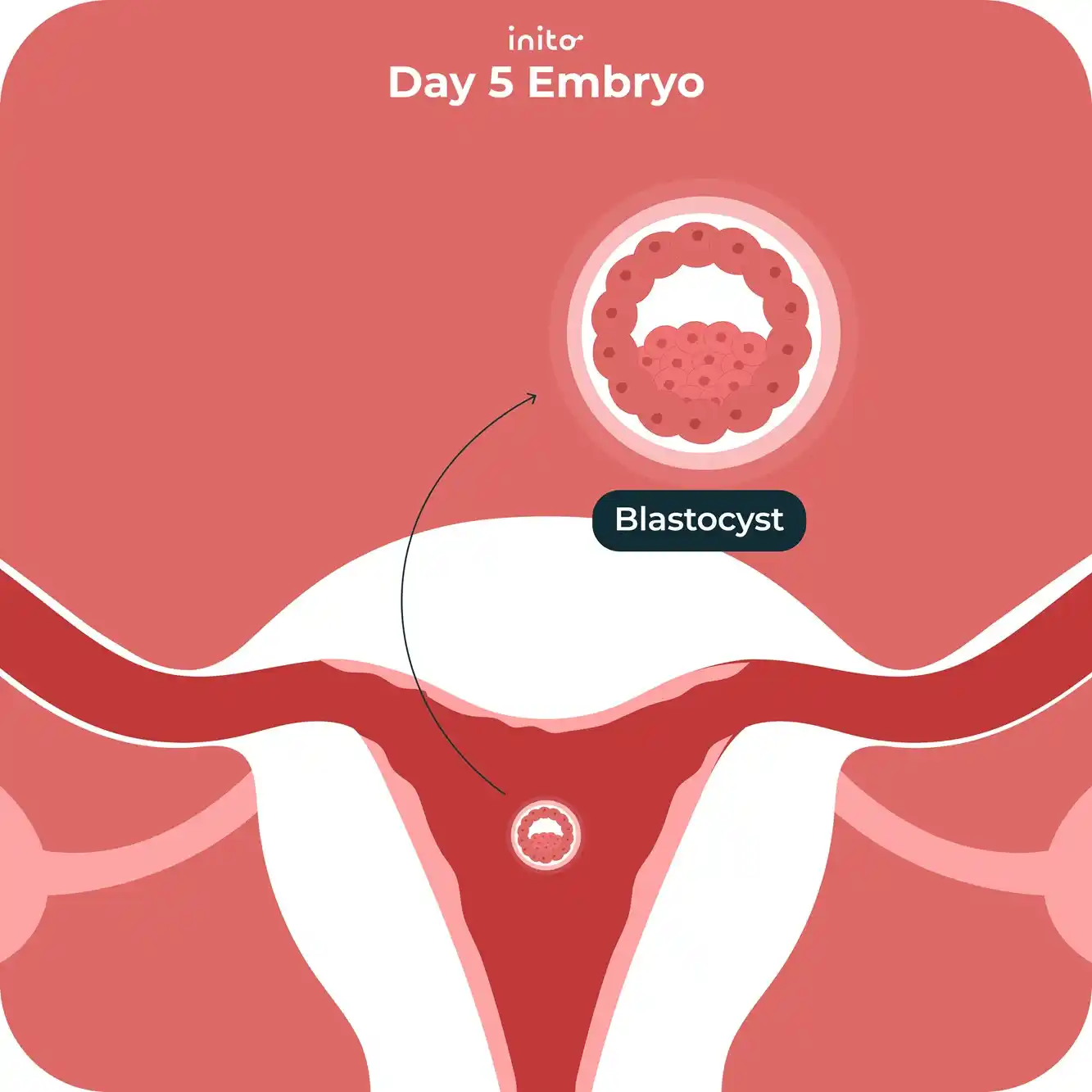 Day 5 embryo