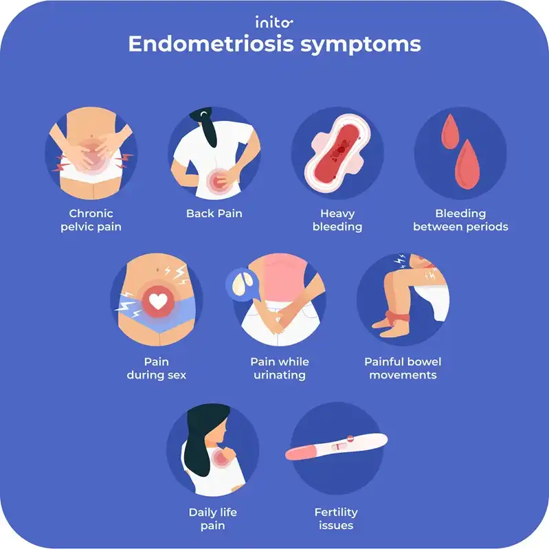 symptoms of endometriosis