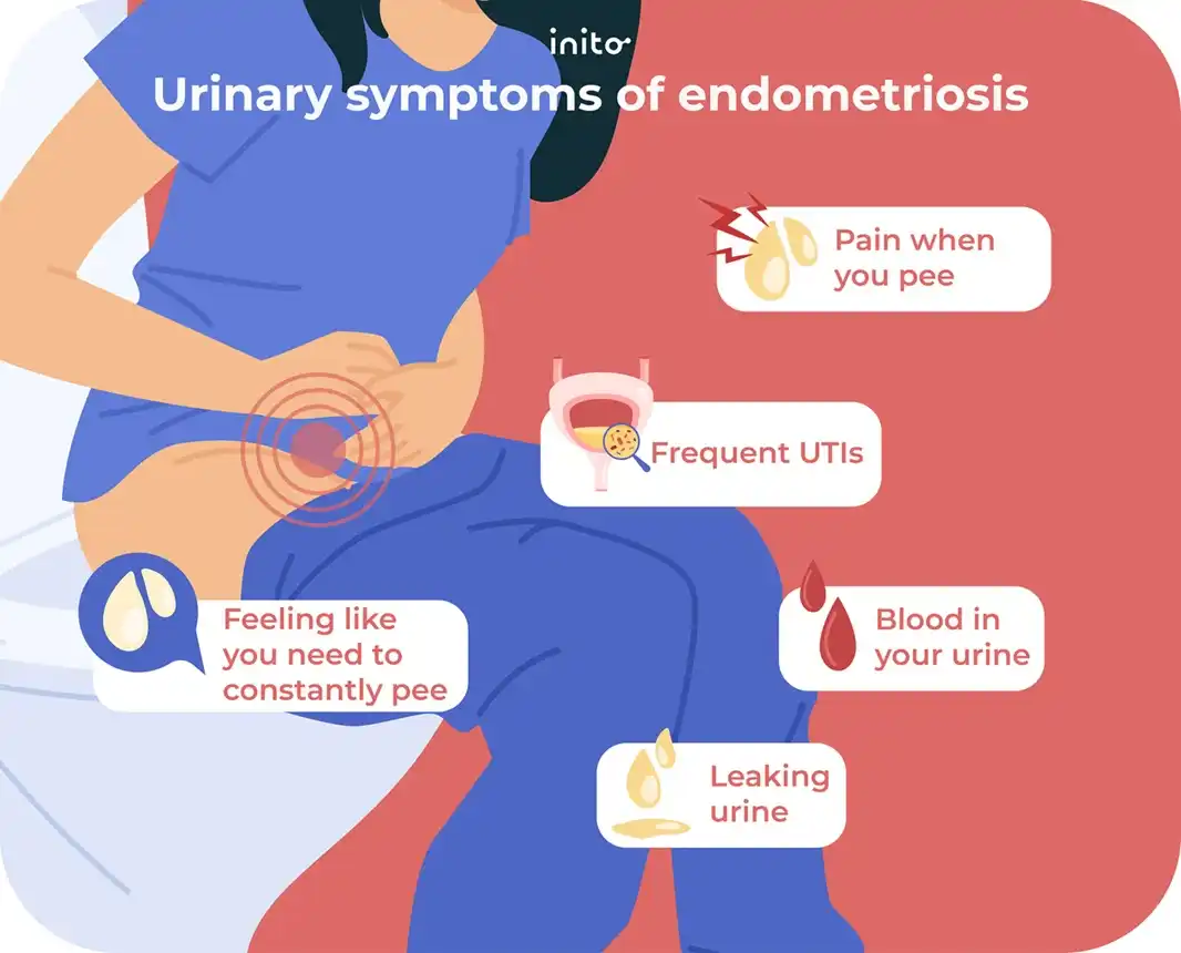 urinary symptoms of endometriosis