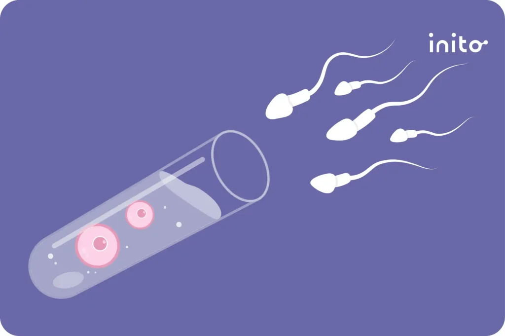 ICSI vs IVF