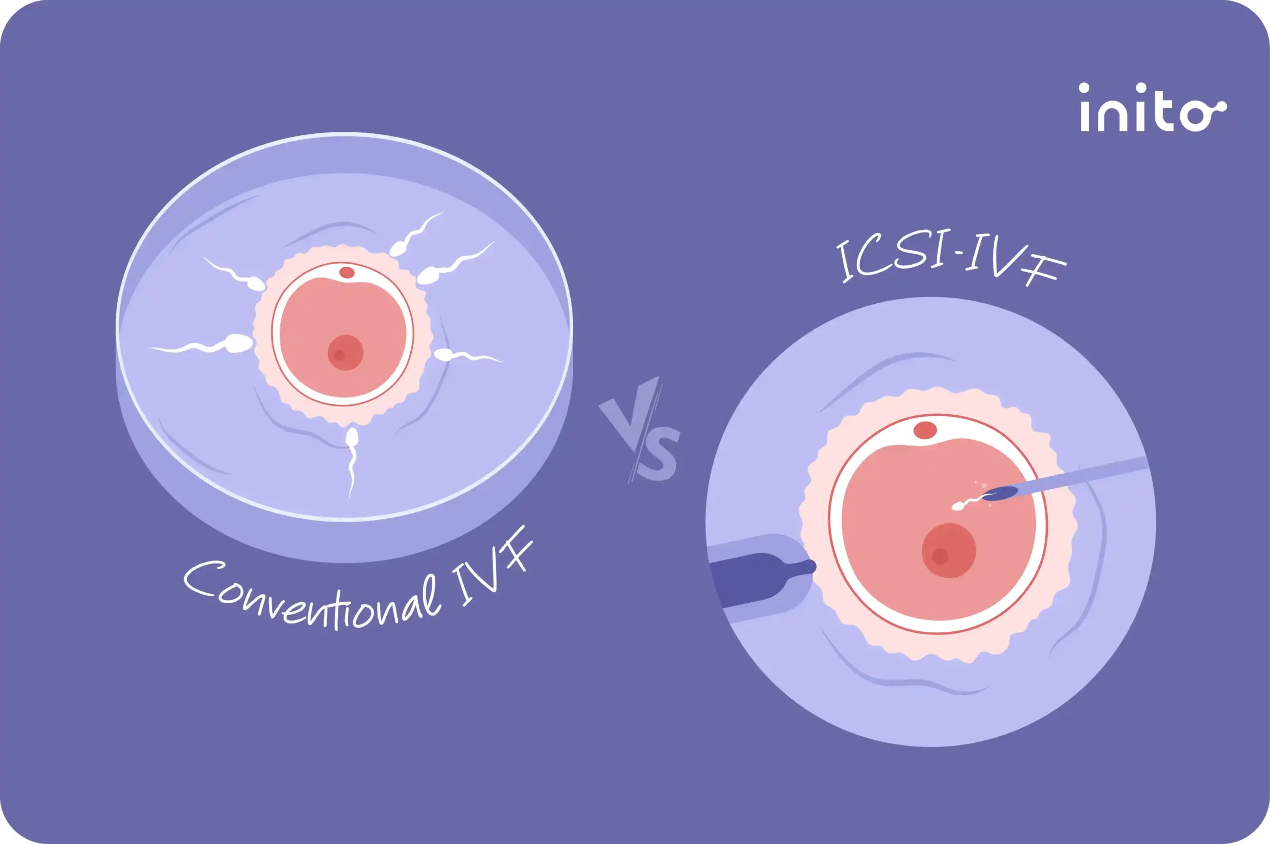 IVF vs. ICSI