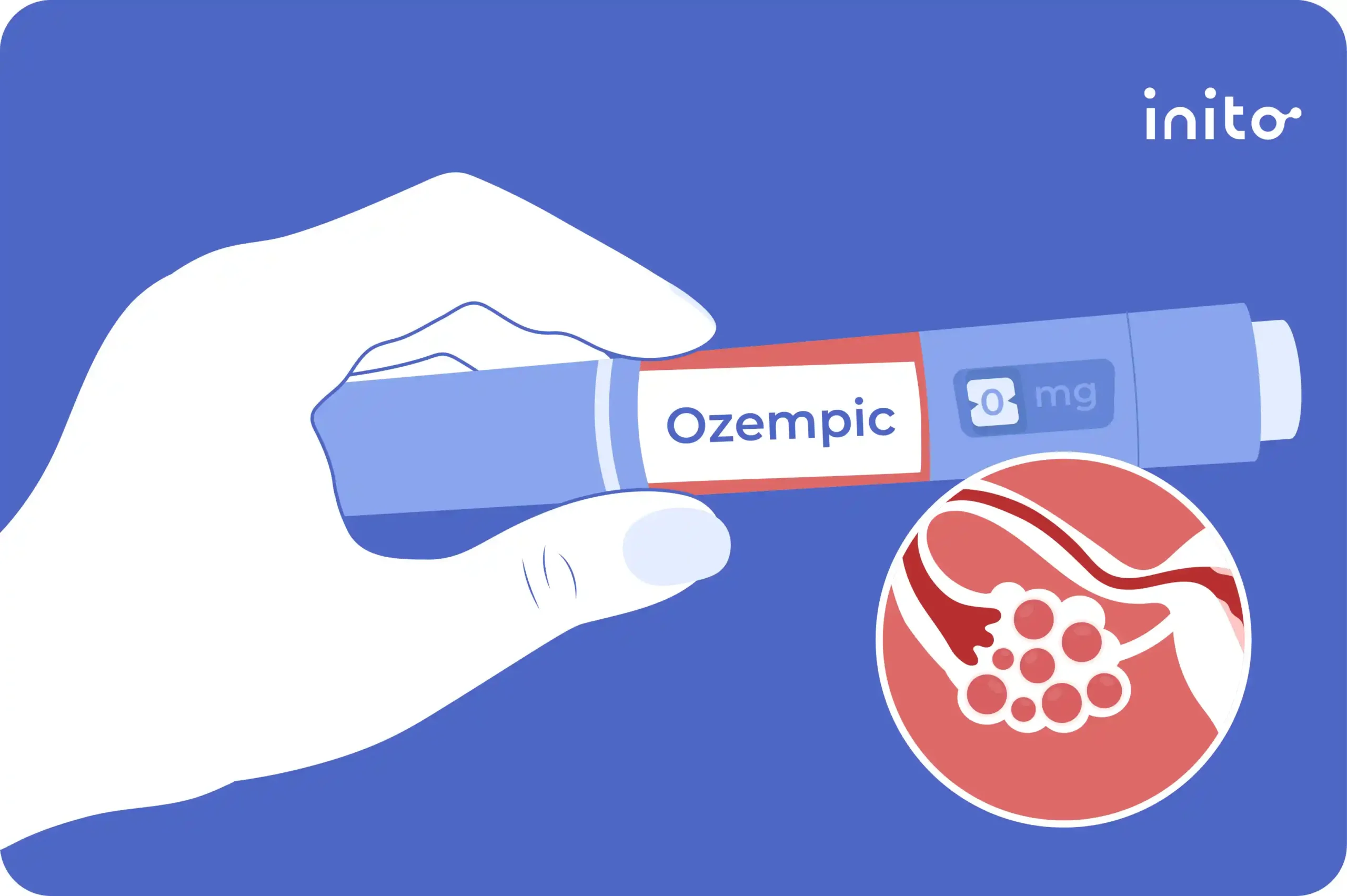 Ozempic for PCOS