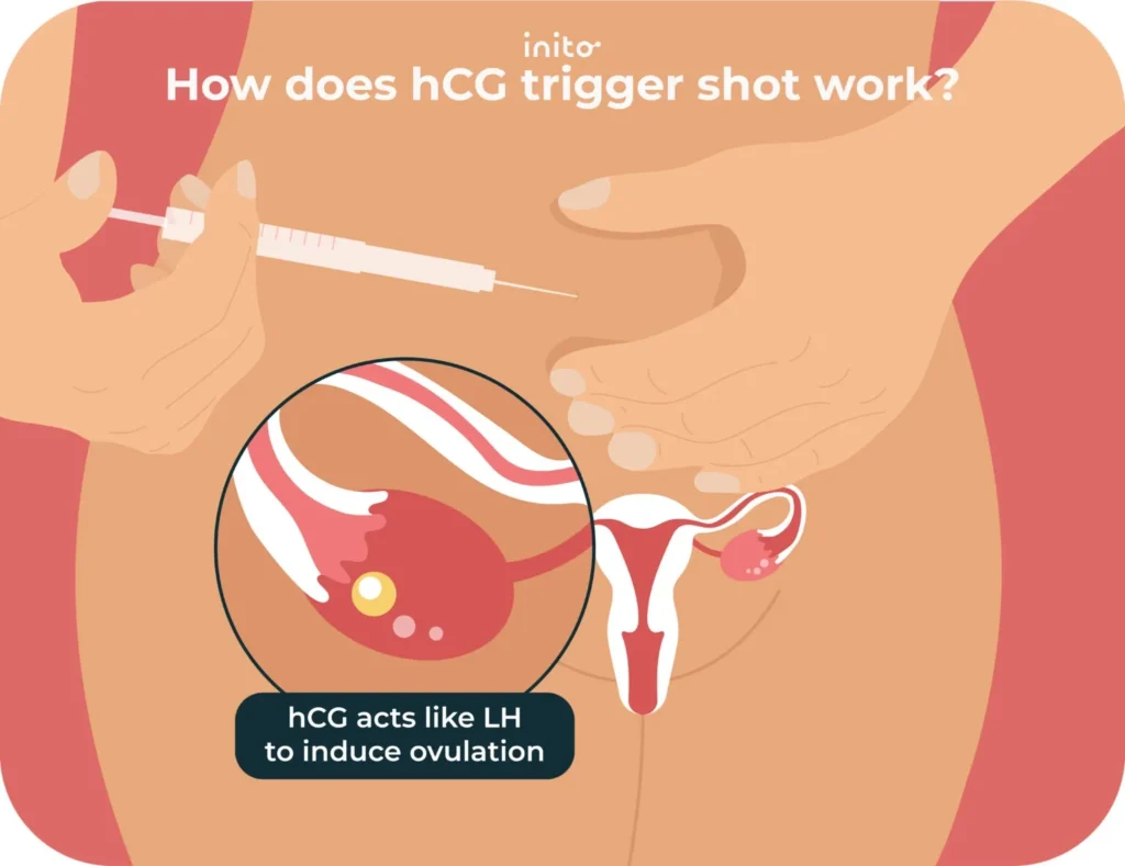 Six Common hCG Trigger Shot Mistakes to Avoid 1 How does hCG trigger shot work?