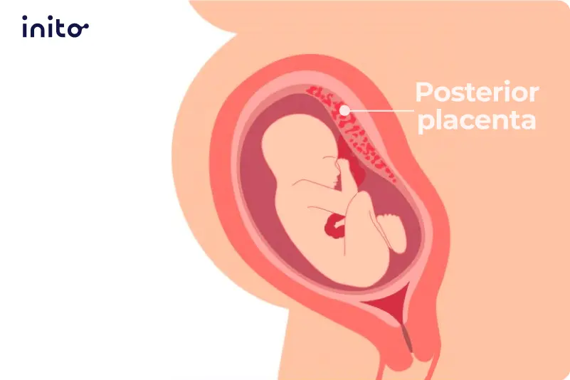Placenta 01