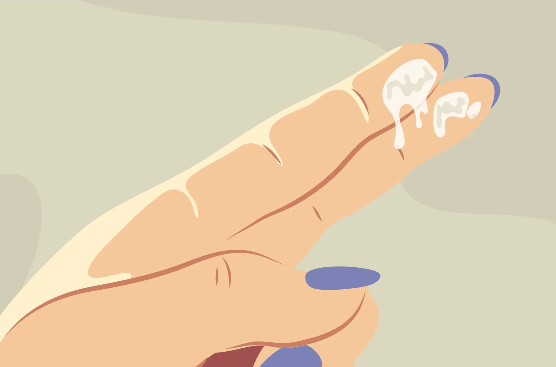 Discharge Before Period vs Early Pregnancy