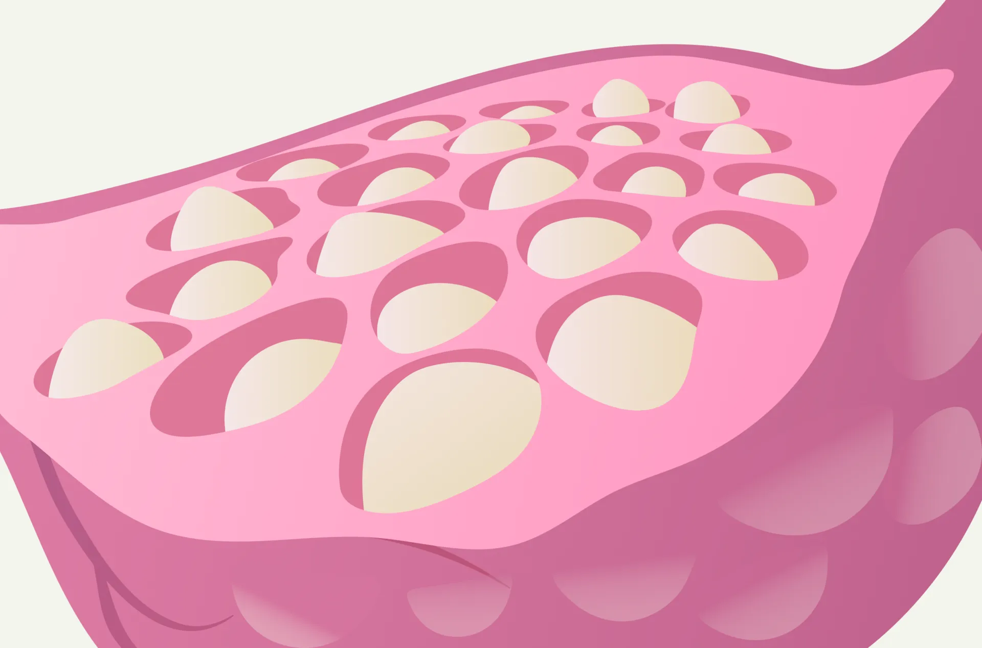 PCO vs. PCOS: Understanding Symptoms and Fertility 2 PCO vs. PCOS