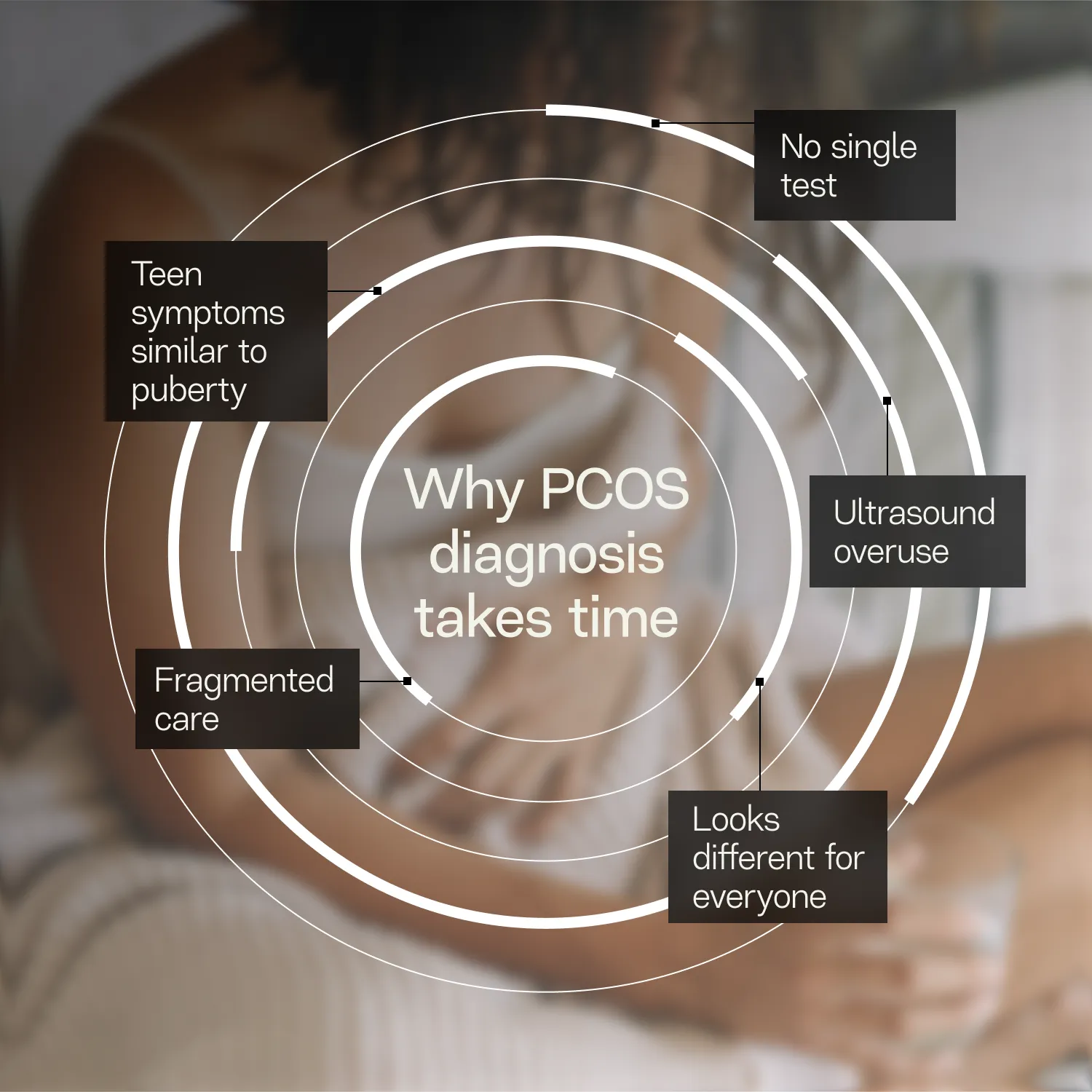Reasons PCOS diagnosis takes time