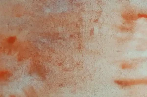 what causes vaginal itching​
