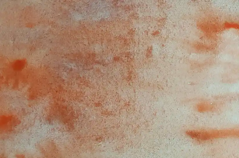 what causes vaginal itching​
