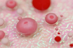 How autoimmune disease affects fertility