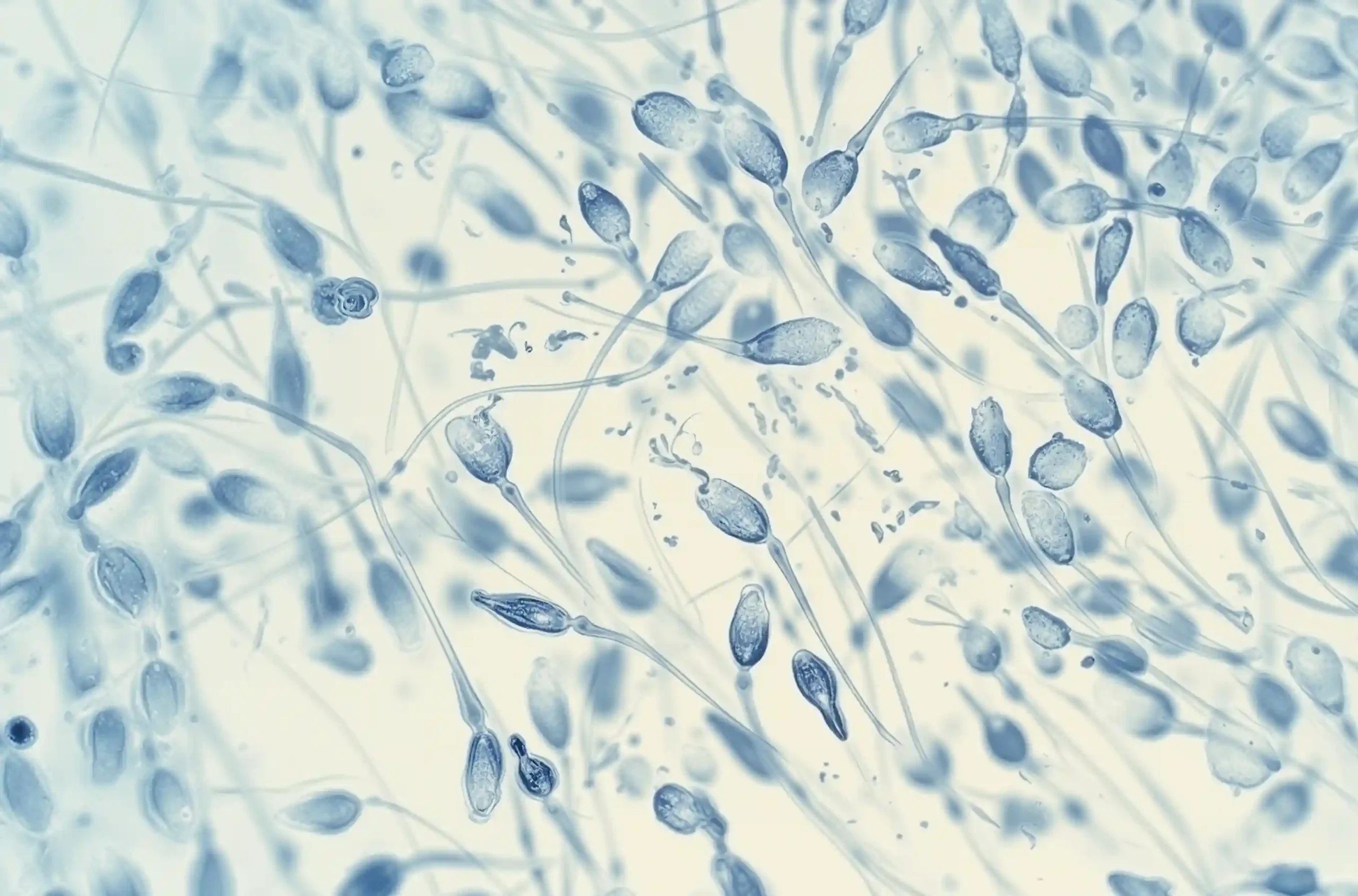 Semen Analysis And Sperm Tests